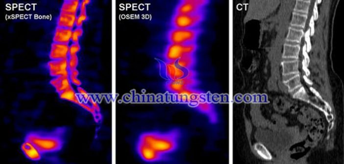 tungsten heavy alloy collimator applied for SPECT picture