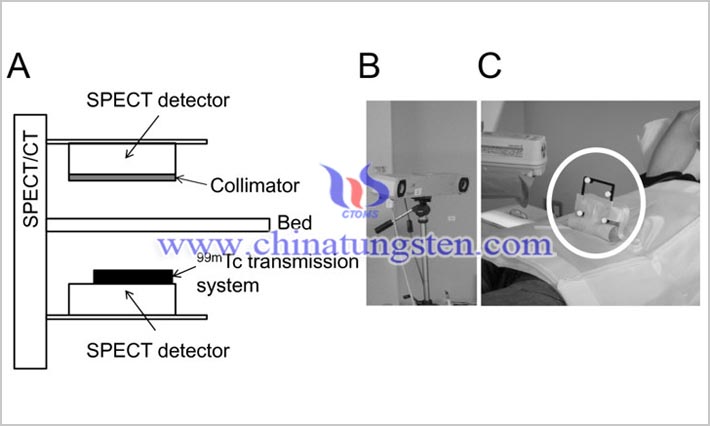 SPECT-CT ???? ??? ??? ?? ?????